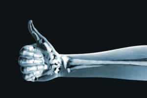 thumbs up healthy bones