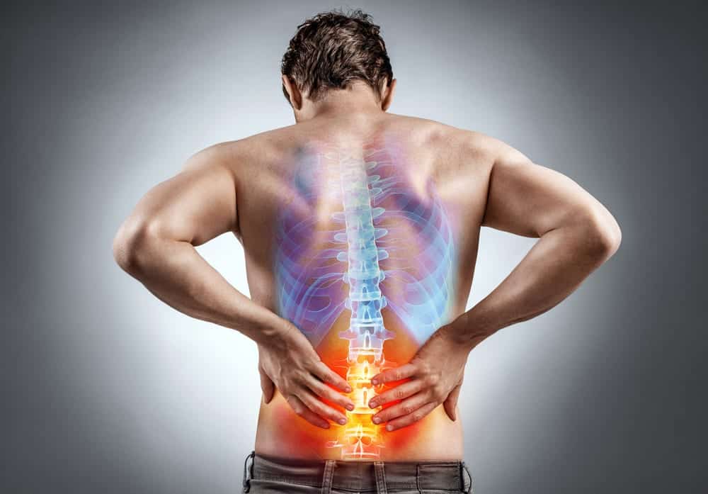 Spinal Fracture - كسر العمود الفقري